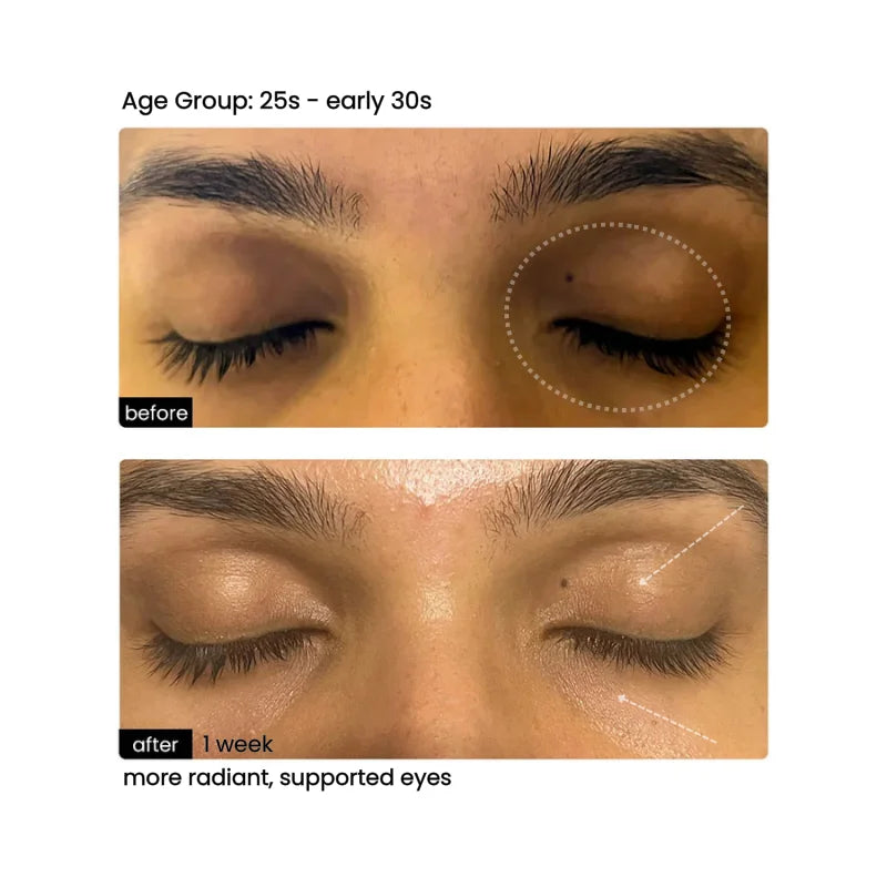 Before/After 1