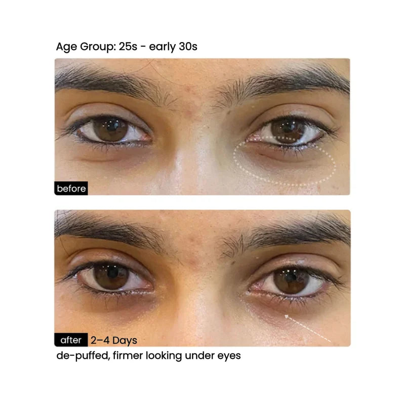 Before/After 2