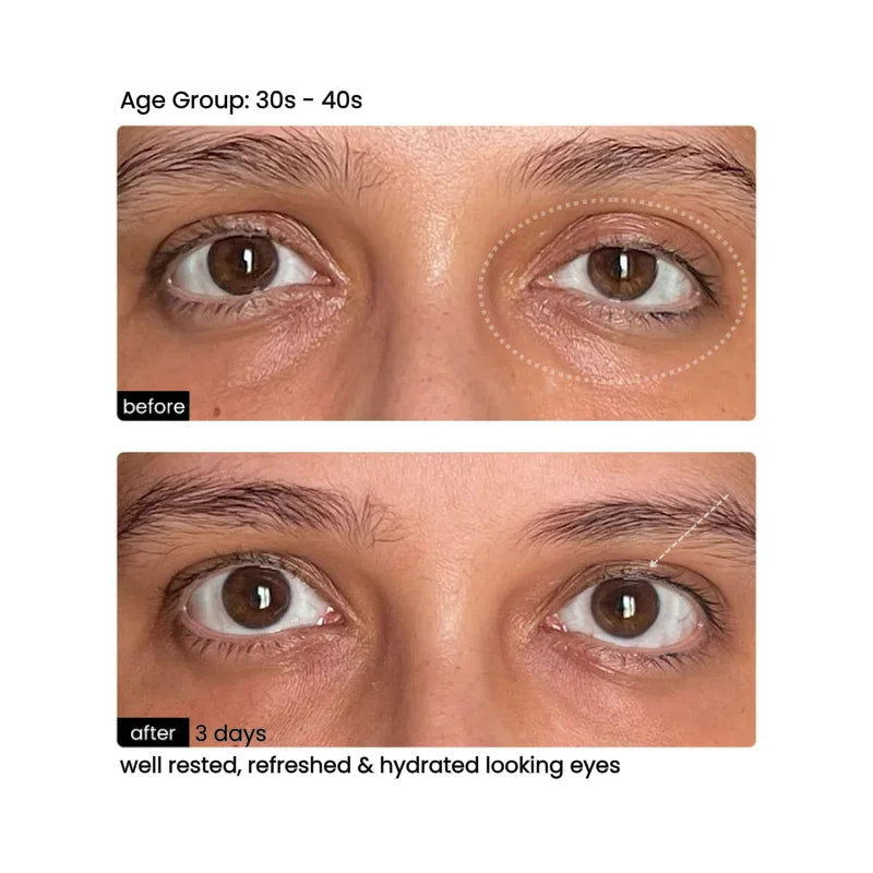 Before/After 3