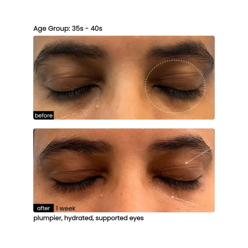 Before/After 4