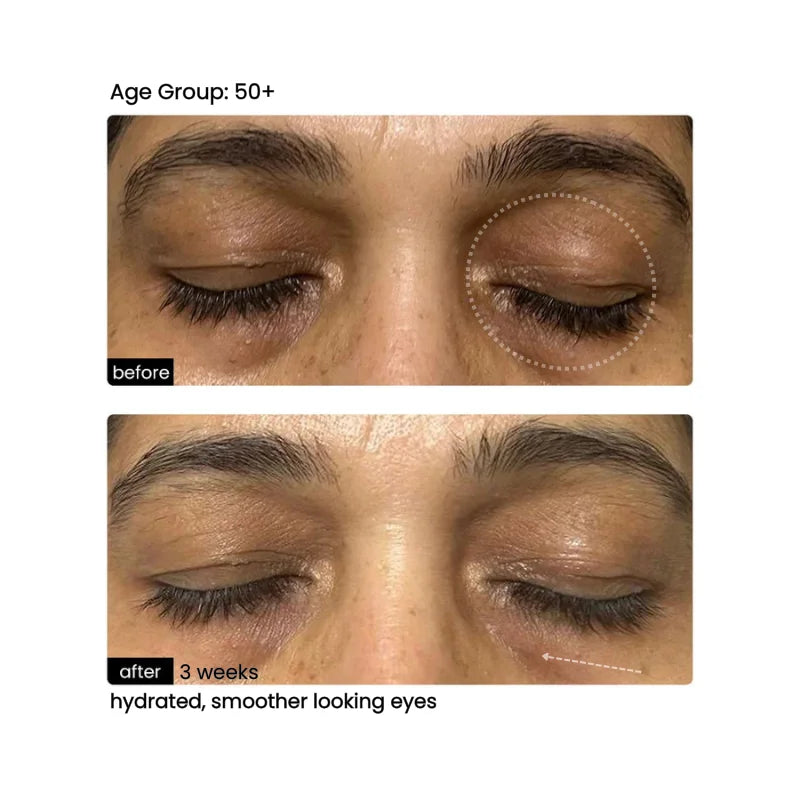 Before/After 5
