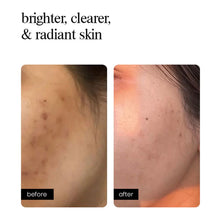 Correcting Concentrate