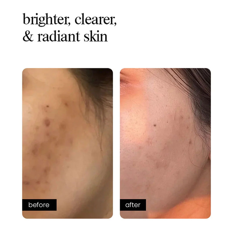 Correcting Concentrate
