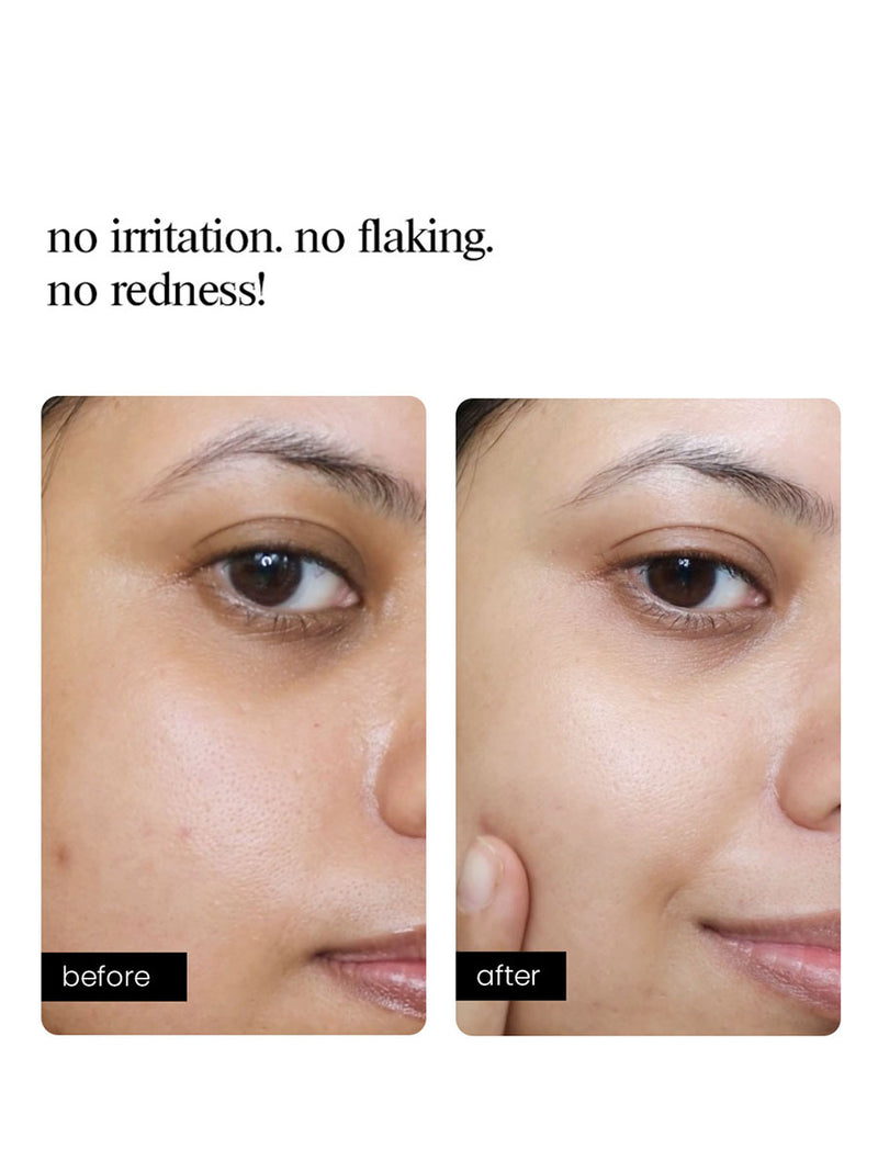 Bio-Retinol Cream