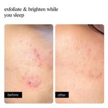 Overnight Peel - AMINU
