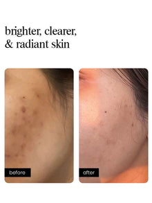 Correcting Concentrate